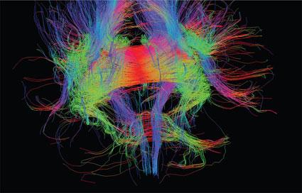 The Conscious Brain | Unframed