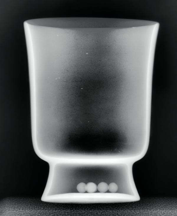 X-radiography of a Maya vase, photo © Museum Associates/LACMA Conservation, by Yosi Pozeilov