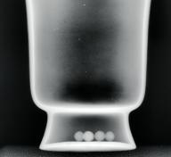 X-radiography of a Maya vase, photo © Museum Associates/LACMA Conservation, by Yosi Pozeilov